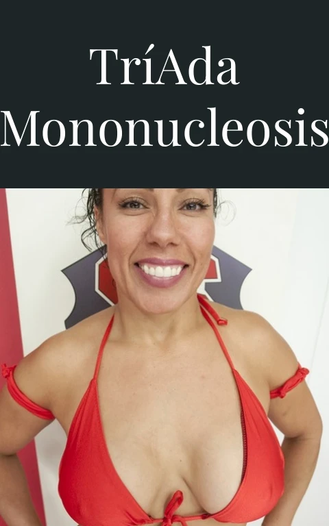 Tríada Mononucleosis